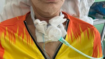 Zbiórka Pomóż uratować moją mamę - miniaturka zdjęcia