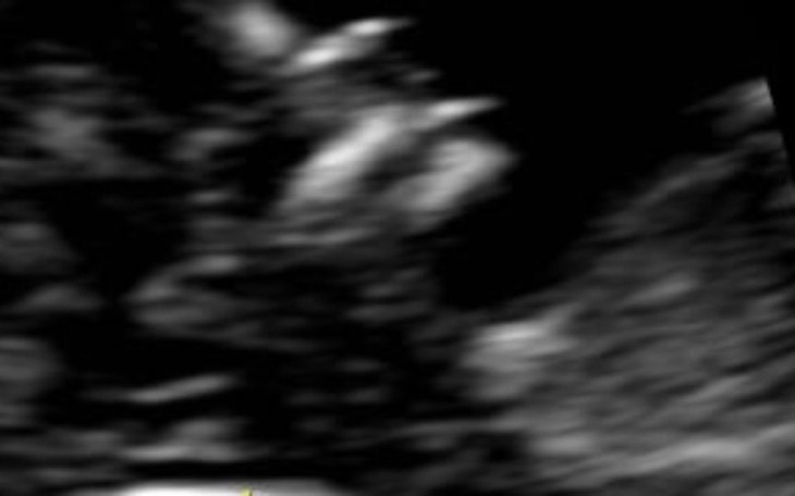 Zbiórka Wynajem mieszkania dla pary - zdjęcie główne