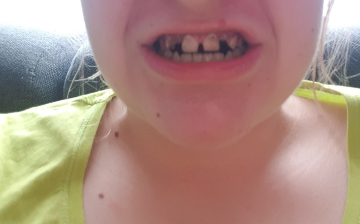 Zbiórka Chciała bym się uśmiechnąć - zdjęcie główne