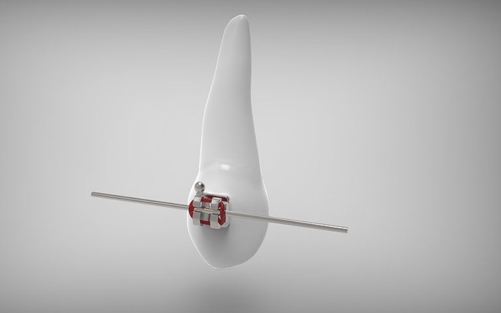 Zbiórka Aparat ortodontyczny dla Martyny - zdjęcie główne