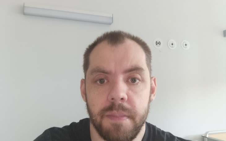 Mężczyzna w szpitalu, z widoczną blizną na twarzy.