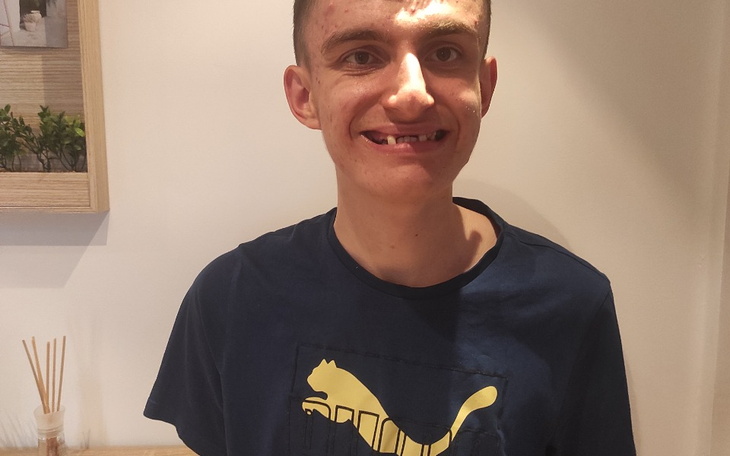 Zbiórka Genetyczny zanik kości żuchwy - zdjęcie główne