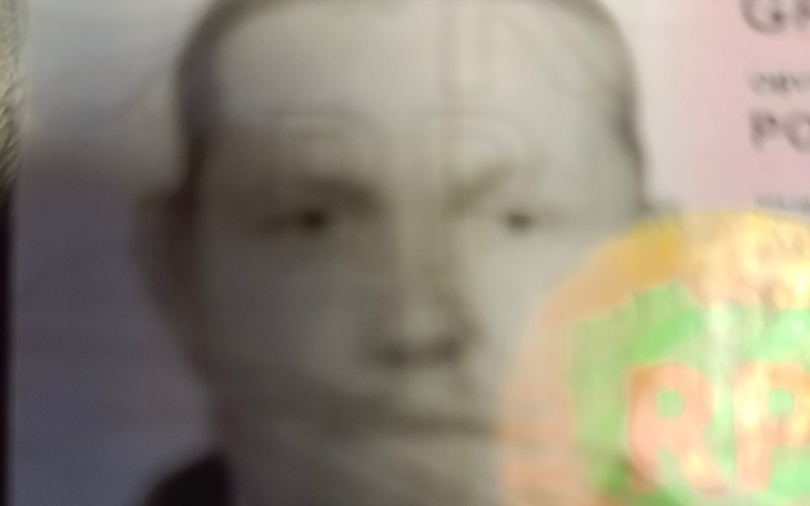 Zbiórka Zbiórka na operację szczęki - zdjęcie główne