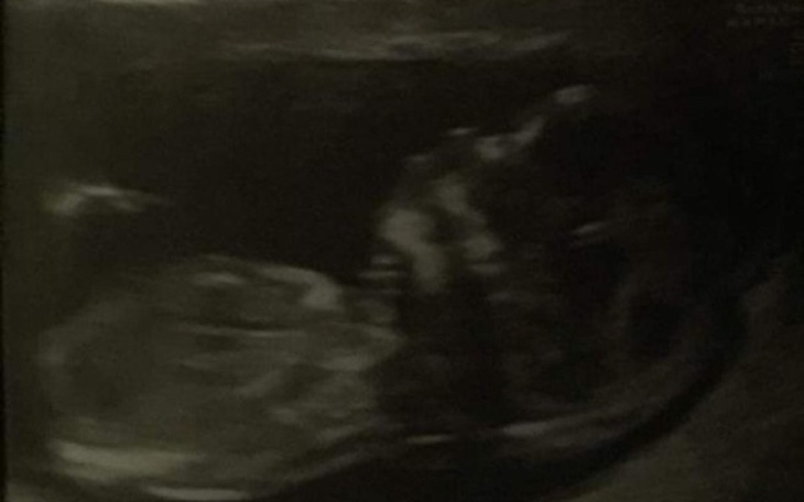 Zbiórka Wyprawka dla bliźniakow - zdjęcie główne