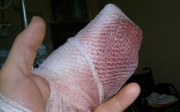 Zbiórka Zbiórka na uratowanie mojego pal - zdjęcie główne