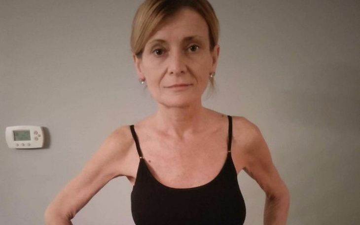 Zbiórka pomoc dla Ilony chorej na raka - zdjęcie główne