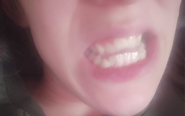 Zbiórka Operacja o lepszy zgryz i zdrowi - zdjęcie główne