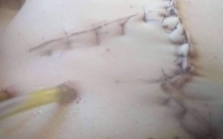 Zbiórka Zbieram na leki i rechabilitacji - zdjęcie główne