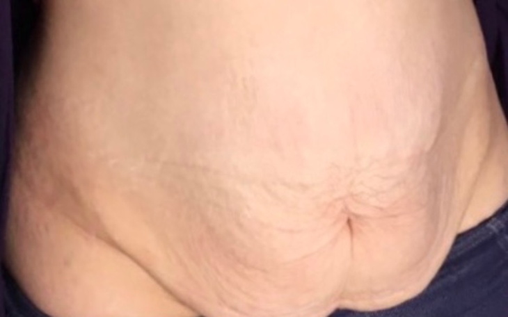 Zbiórka Plastyka Ciała - zdjęcie główne