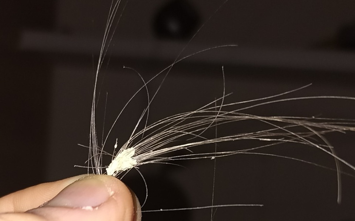 Zbiórka Chce w końcu żyć normalnie - zdjęcie główne