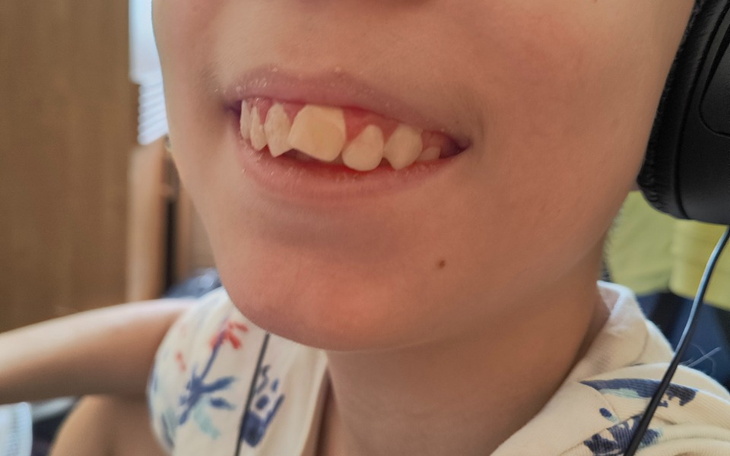 Zbiórka Na uśmiech nastolatka - zdjęcie główne