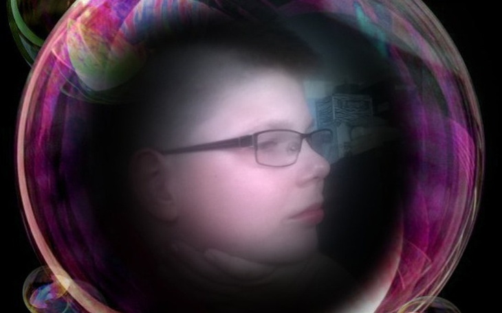 Zbiórka Ratujmy oczka Oskarka - zdjęcie główne