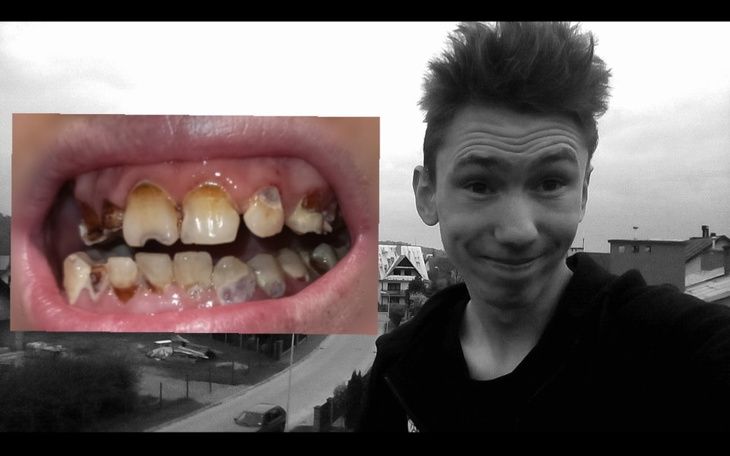 Zbiórka Pomóż odzyskać stary uśmiech - zdjęcie główne