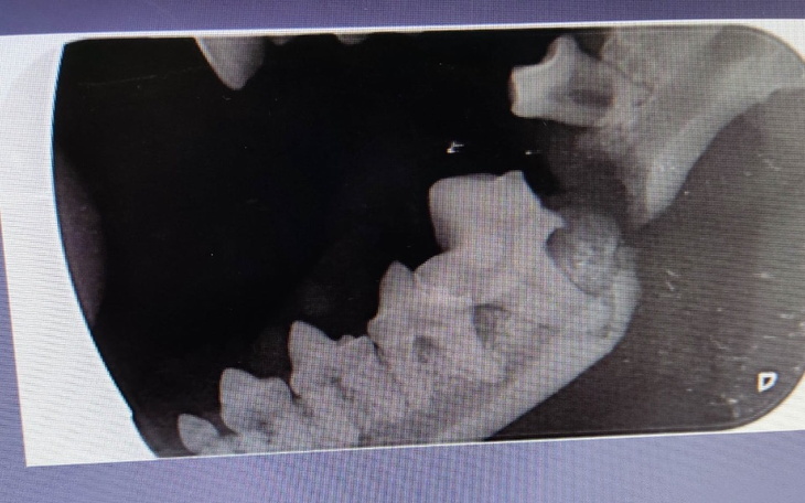 Zbiórka Pęknięta żuchwa małej szpicki - zdjęcie główne