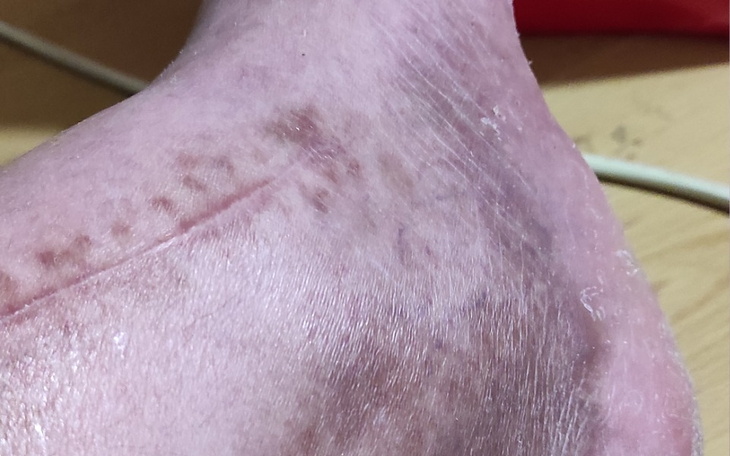 Zbiórka Rehabilitacja nogi marynarza - zdjęcie główne