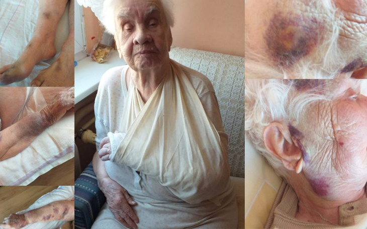 Zbiórka Pomoc dla 96-letniej babci - zdjęcie główne