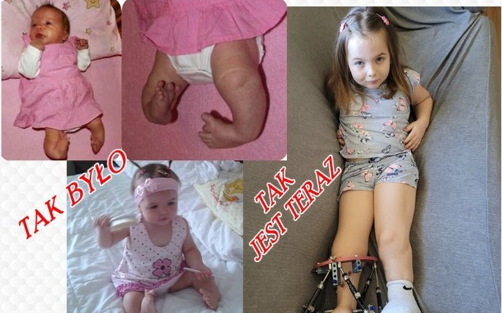Kolaż zdjęć małej dziewczynki, pokazujący jej rozwój.
