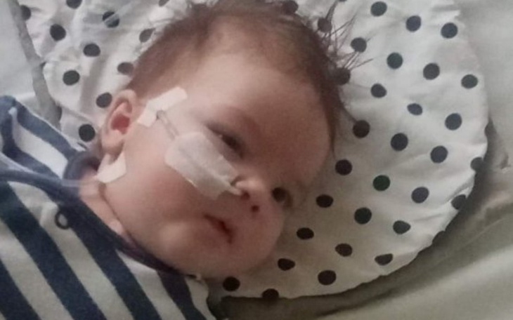 Mały chłopiec z rurką tlenową leży na poduszce w kropki.