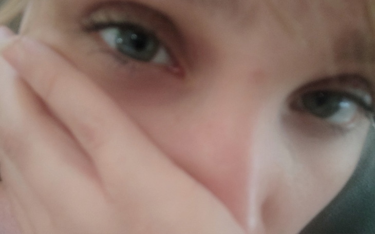 Zbiórka Proszę o pomoc odnośnie operacji - zdjęcie główne