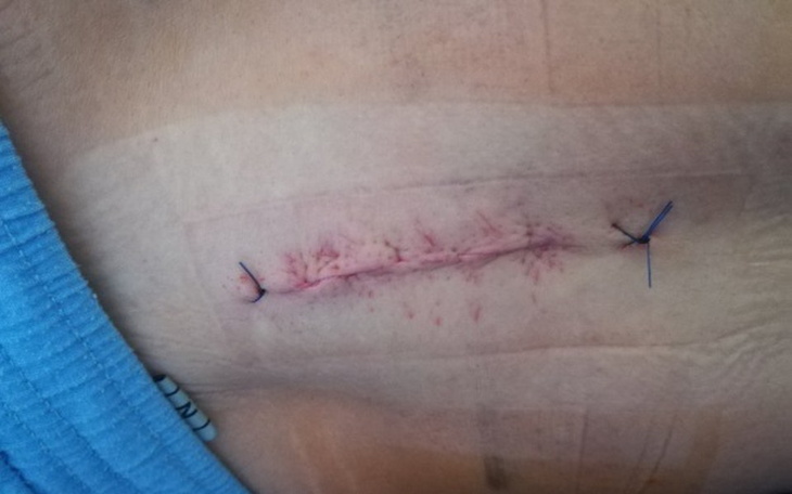 Zbiórka Rehabilitacjje kręgosłupa lędźwi - zdjęcie główne