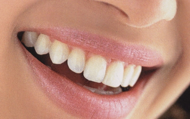 Zbiórka Zdrowe zęby,stomatolog - zdjęcie główne