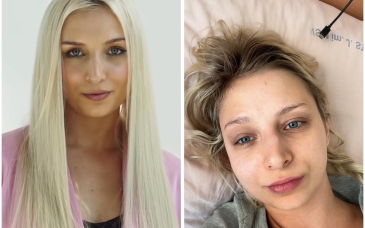 Zbiórka Kasia potrzebuje pilnej operacji - zdjęcie główne