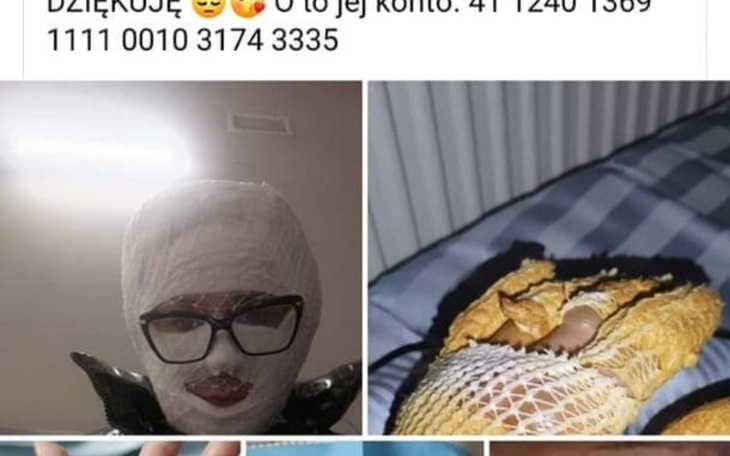 Zbiórka Na rehabilitację dla koleżanki - zdjęcie główne