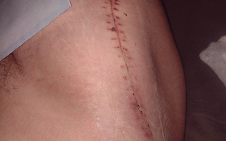 Klatka z kociętami, jedno z nich głośno miauczy.