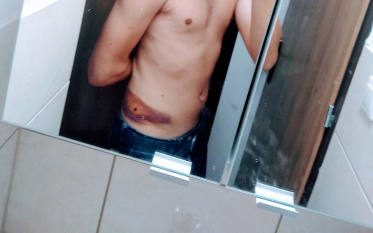 Zbiórka Naprawa Biodra - zdjęcie główne