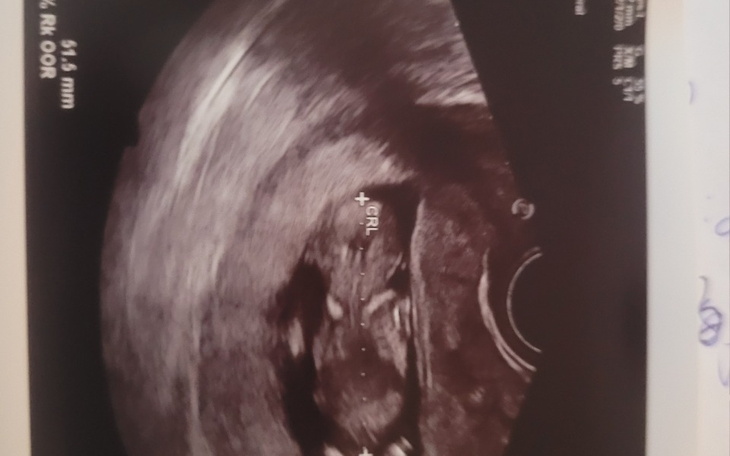 Zbiórka Wyjście z długow - zdjęcie główne