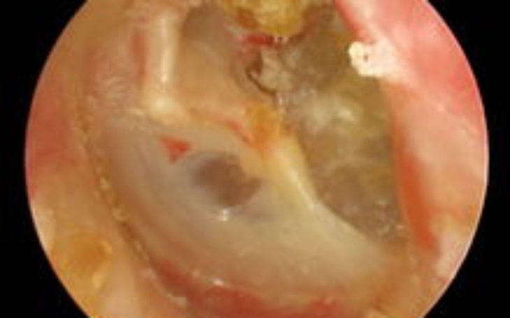 Zbiórka Pilna operacja przeszczepu - zdjęcie główne