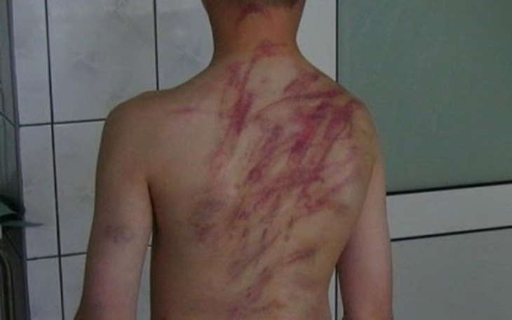 Zbiórka Mateusz Potrzebuje Waszej Pomocy - zdjęcie główne