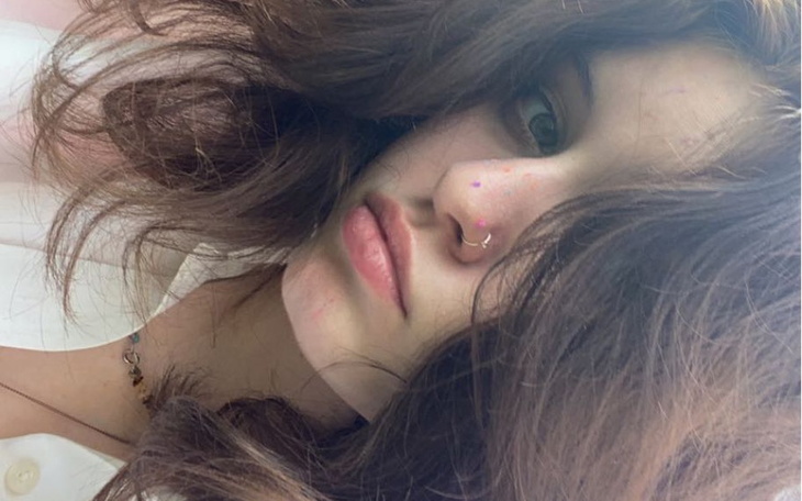 Zbiórka Leczenie anoreksji turnus 10 tyg - zdjęcie główne