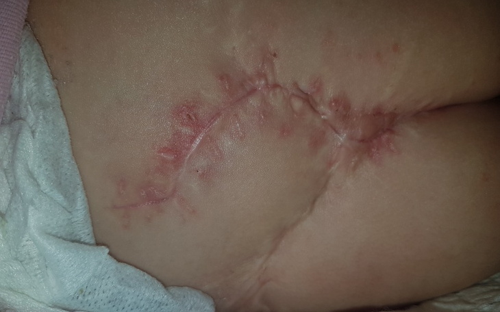 Zbiórka Miesięczna rehabilitacja - zdjęcie główne