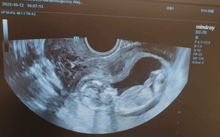 Zbiórka Na lepsze życie i nowy start - zdjęcie główne