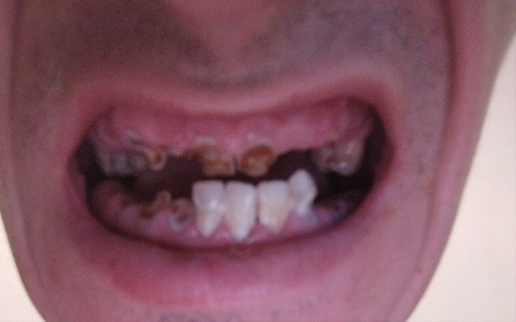 Zbiórka Leczenie kliniczne zębów - zdjęcie główne