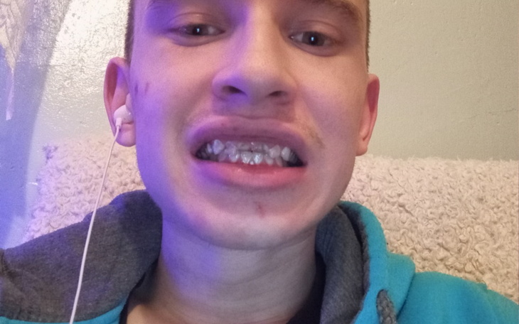 Zbiórka Zbieram na implant jedynki . - zdjęcie główne