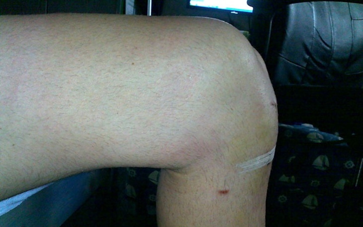 Zbiórka Operacja nóg ważny jest czas - zdjęcie główne