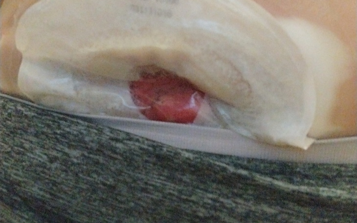 Zbiórka Na leki i sprzęt stomijny - zdjęcie główne