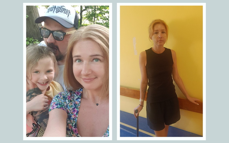 Kobieta w dwóch ujęciach, przed i po zmianach.