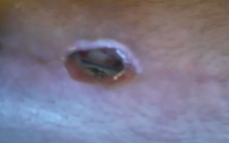 Zbiórka Rechabilitacyjny - zdjęcie główne