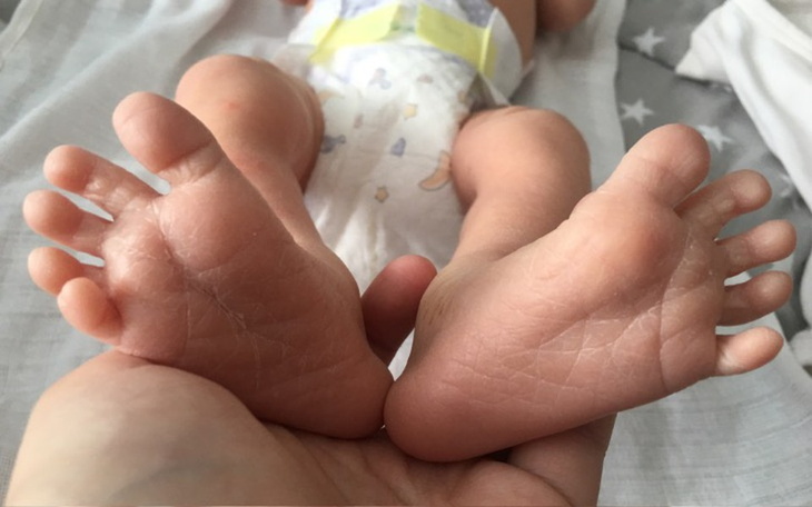 Zbiórka Samotna matka i jej życie - zdjęcie główne