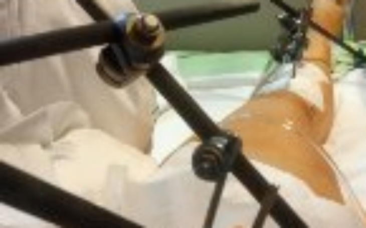 Zbiórka Pomoz mi wrócić do sprawności - zdjęcie główne