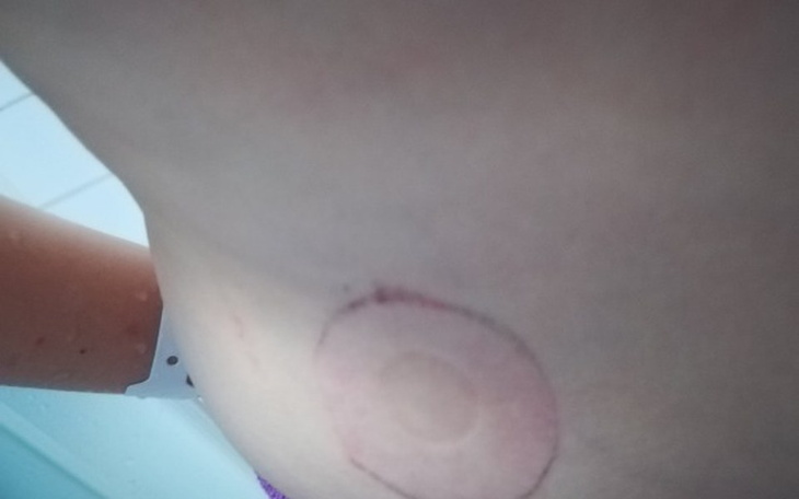 Zbiórka Wyjazd  z synem chorym na astmę - zdjęcie główne