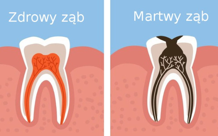 Zbiórka Na implanty . - zdjęcie główne