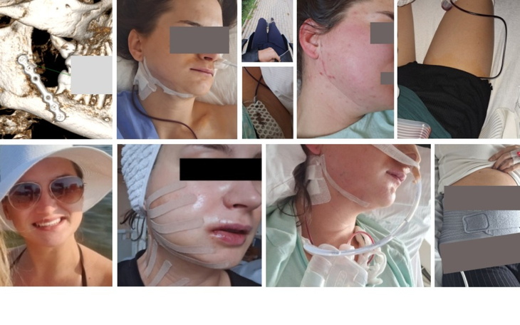 Kolaż zdjęć przedstawiających różne etapy leczenia.