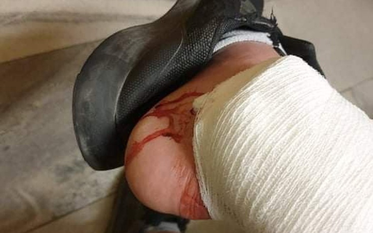 Zbiórka Rehabilitacja dla motocyklisty - zdjęcie główne