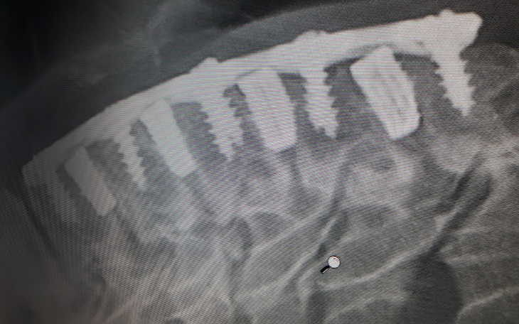 Zbiórka Leczenie i wizyty lekarskie - zdjęcie główne