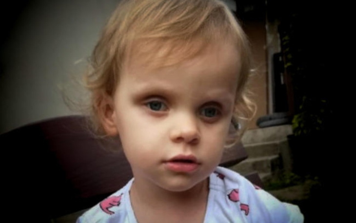 Zbiórka pomoż sarci zobaczyć slonce - zdjęcie główne