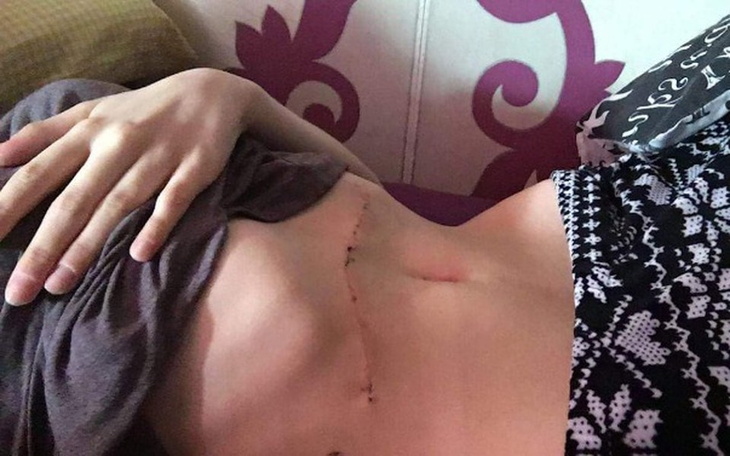 Zbiórka Nowotwór-leczenie i rehabilitacj - zdjęcie główne